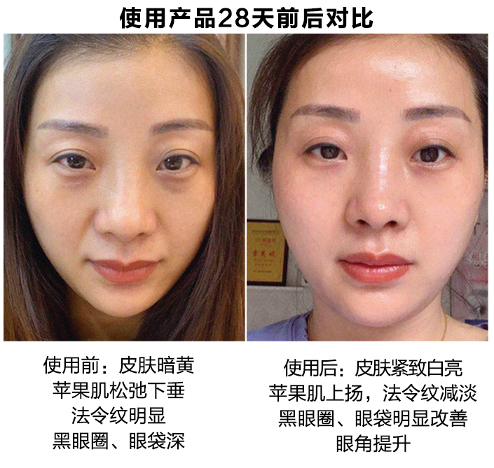 使用28天前后对比图
