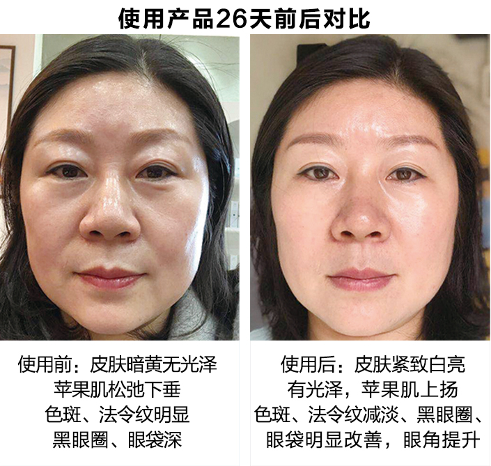 使用产品26天前后对比图