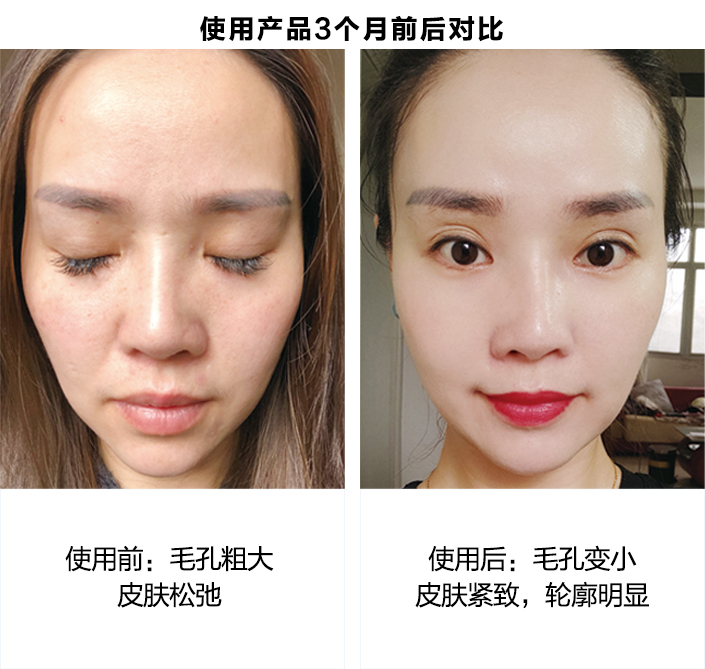 使用产品3个月前后对比图