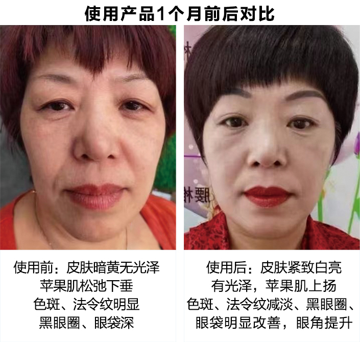 使用产品1个月前后对比图