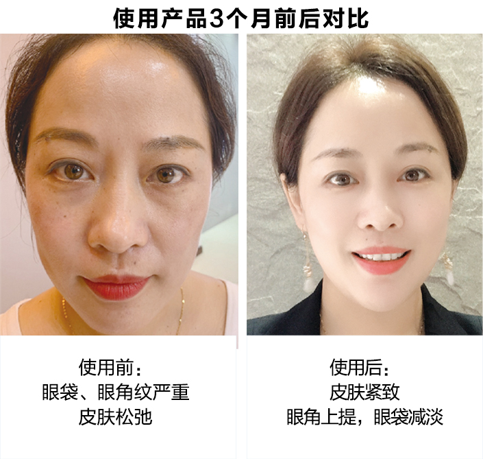 使用产品3个月前后对比图