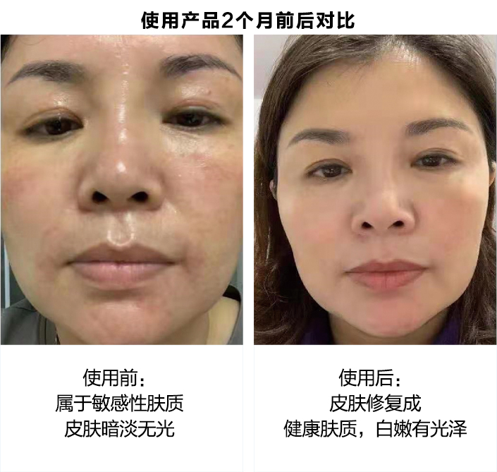 使用产品2个月前后对比图