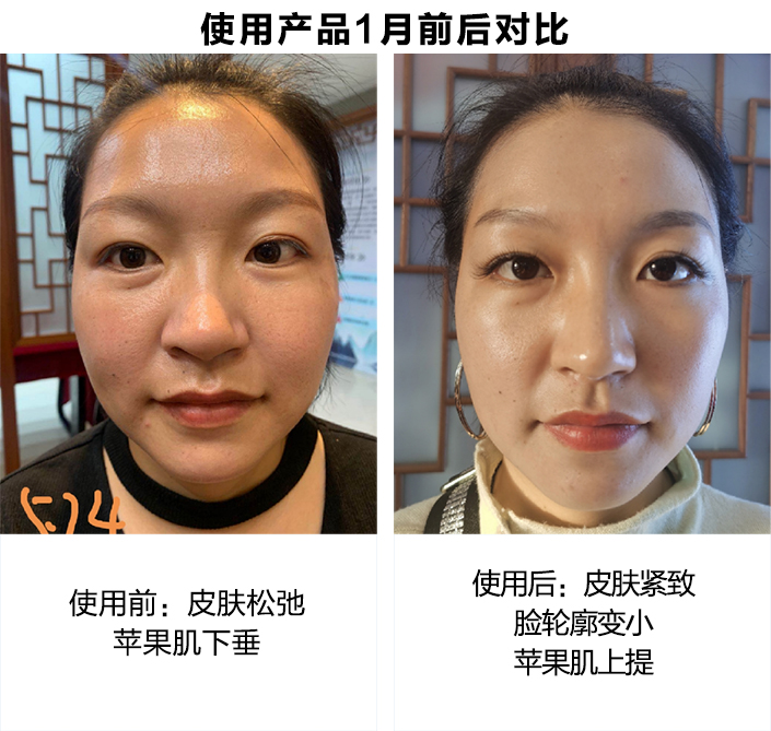 使用产品1个月前后对比图