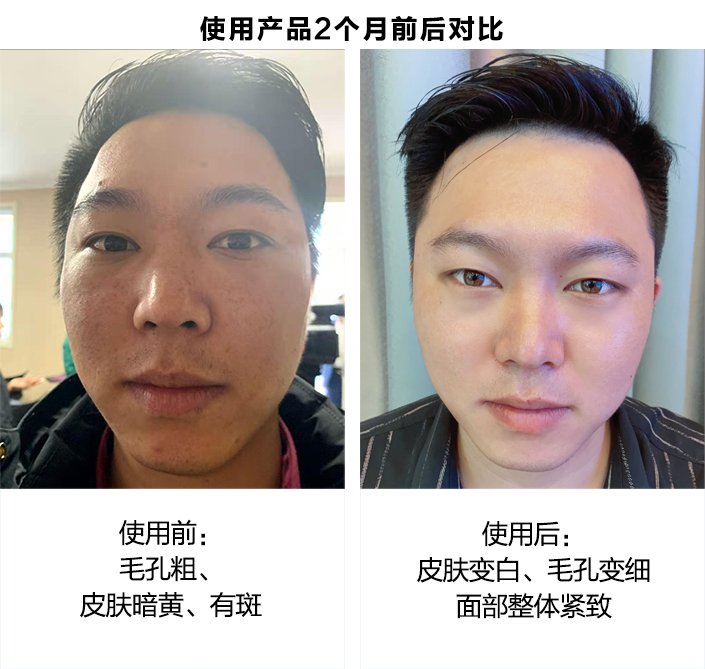 使用产品2个月前后对比图