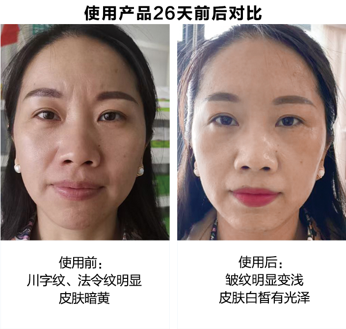 使用产品26天前后对比图