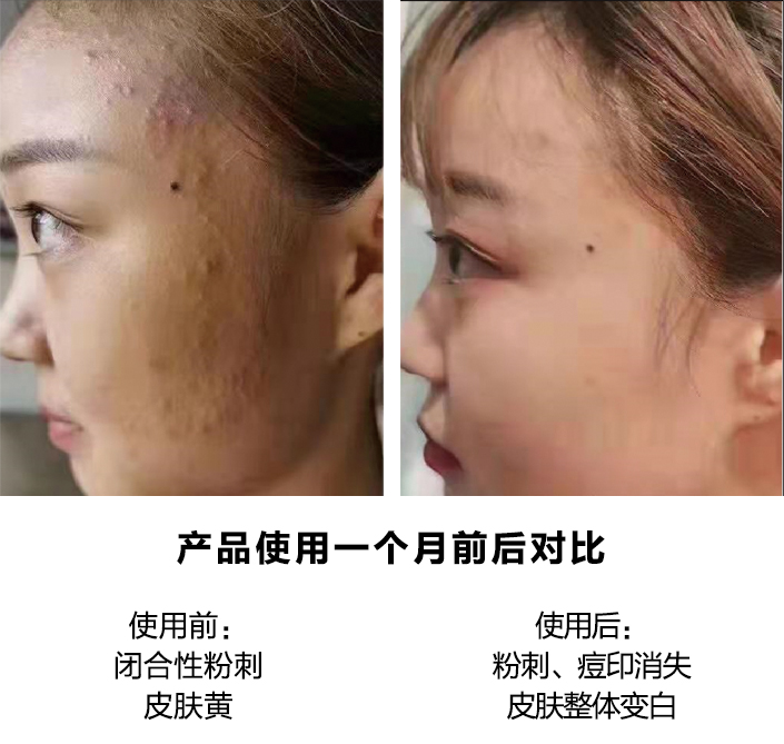 产品使用一个月前后对比图