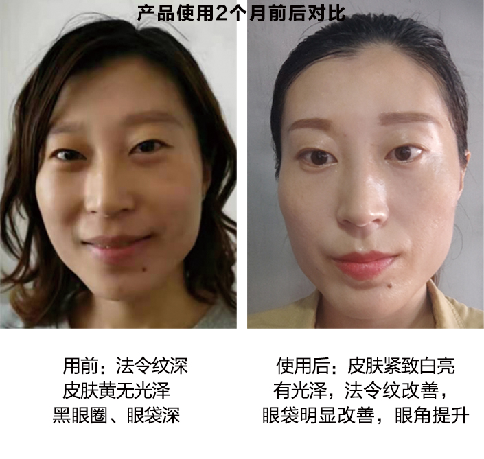 产品使用2个月前后对比图