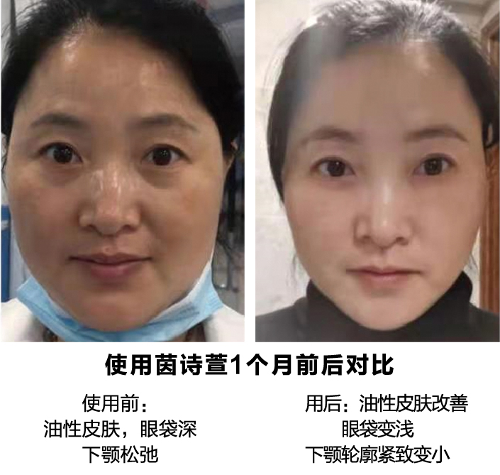 产品使用一个月前后对比图
