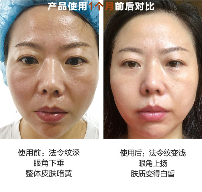 产品使用1个月前后对比图