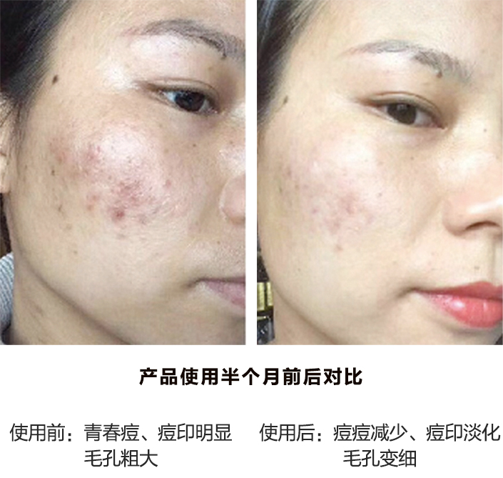 产品使用1个月前后对比图