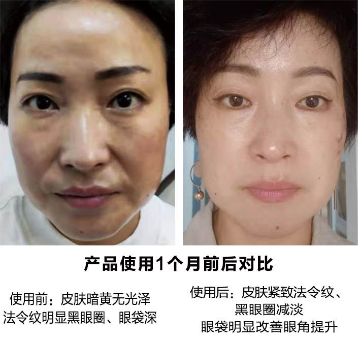 产品使用一个月前后对比图