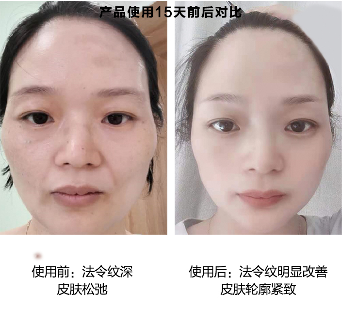 产品使用15天前后对比图